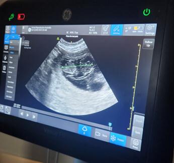 Lagotto Romagnolo for sale by XCERRI